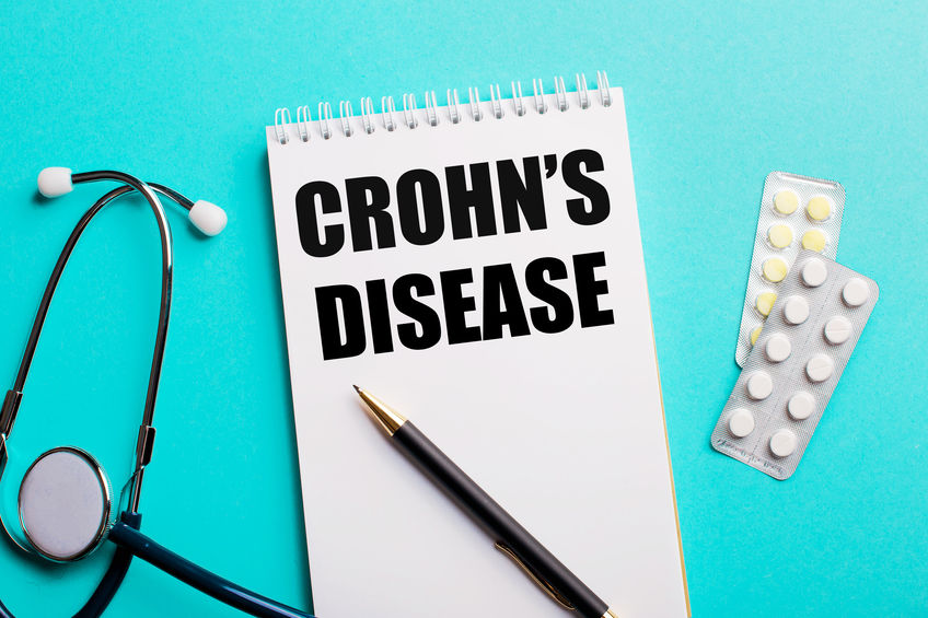Crohn betegség és Crohn-diéta – mintaétrenddel